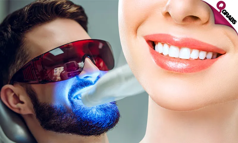 Zoom Teeth Whitening + Dental Consultation!